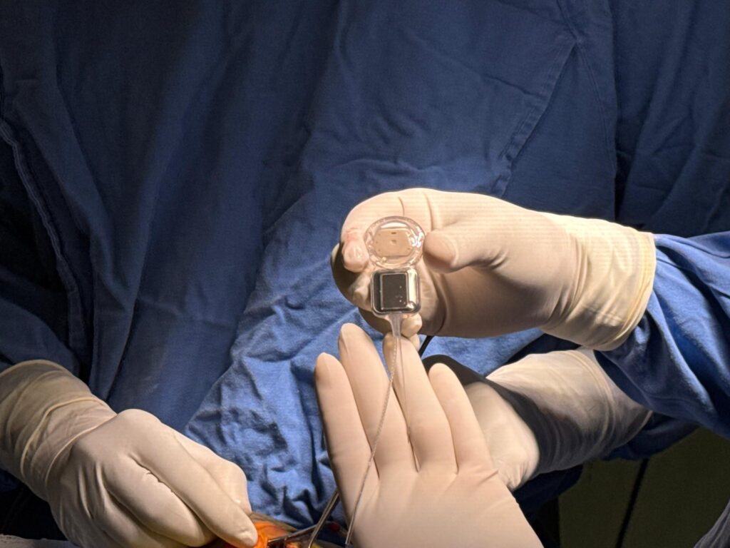 Hospital Pediátrico realiza cirugías de implante coclear