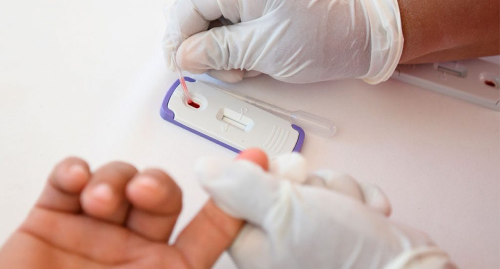 El VIH no es exclusivo de nadie: el mito del “virus gay” retrasa diagnósticos en heterosexuales